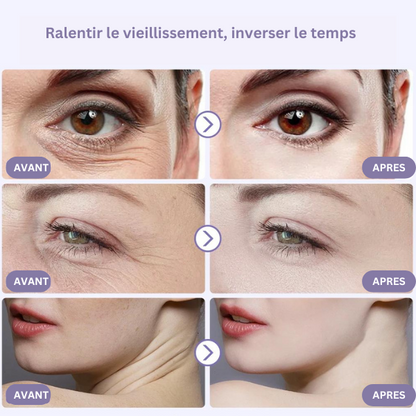 Appareil anti rides : Massage yeux et visage