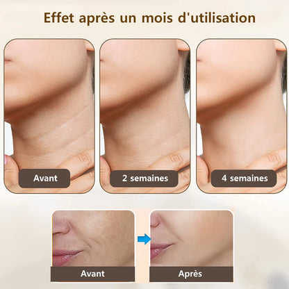 Appareil du lifting facial: visage et cou